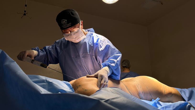 Milton Seigi Hayashi reforça que a Lipo HD busca contornos marcados sem perder naturalidade.